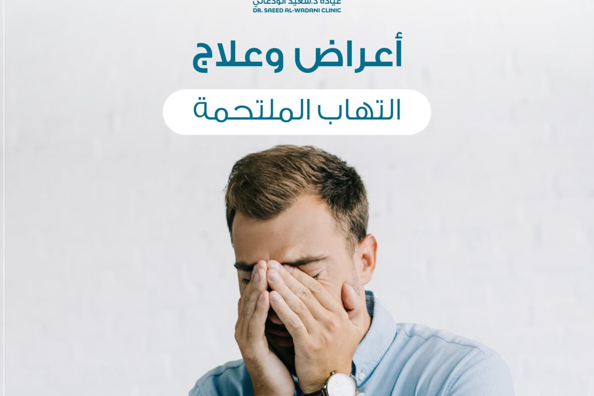 التهاب الملتحمة هو حالة تصيب الملتحمة، وهي طبقة رقيقة من الأنسجة الموجودة في جزء العين الأمامي.