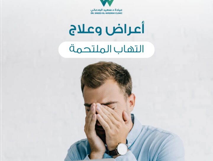 التهاب الملتحمة هو حالة تصيب الملتحمة، وهي طبقة رقيقة من الأنسجة الموجودة في جزء العين الأمامي.