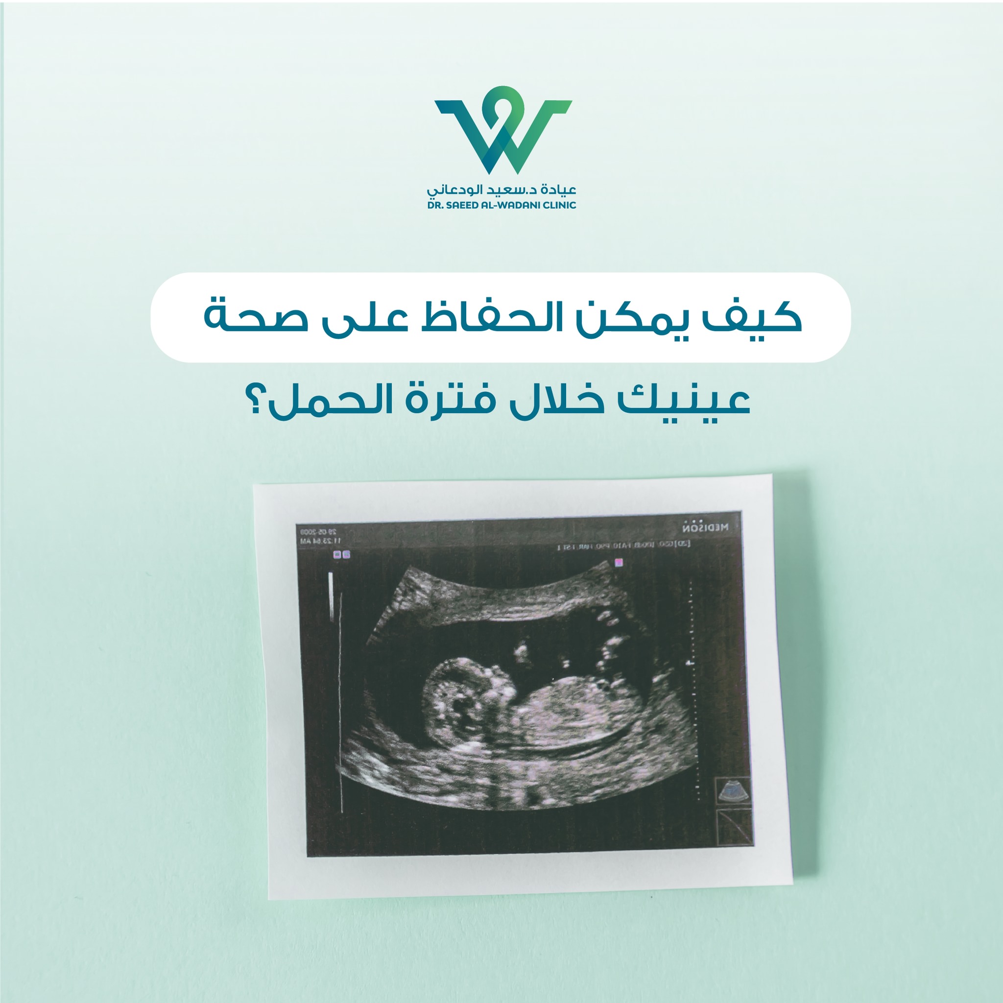 صحة العيون خلال الحمل، تعتبر فترة الحمل واحدة من أكثر الفترات تحديًا لصحة العينين للمرأة الحامل. يمكن أن تتعرض العينان للعديد من المشاكل والتغيرات أثناء الحمل