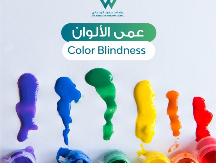 عمى الألوان هو حالة يصعب على الشخص القدرة على التمييز بين الألوان المختلفة. يعتبر عمى الألوان اضطرابًا ناتجًا عن عدم تواجد أو عدم صحة بعض المستقبلات البصرية في عيني الشخص.