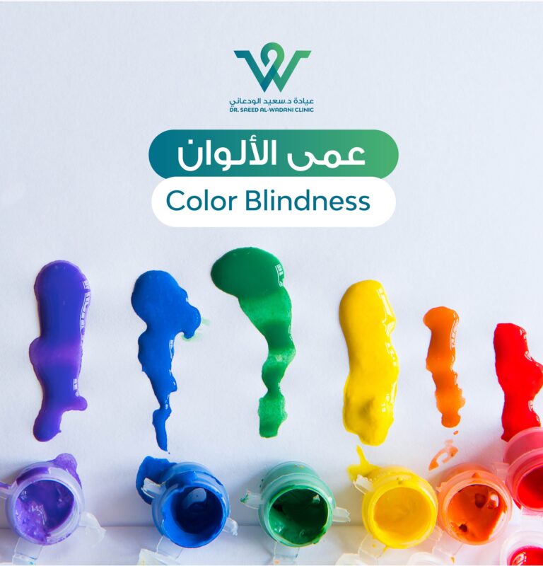 عمى الألوان هو حالة يصعب على الشخص القدرة على التمييز بين الألوان المختلفة. يعتبر عمى الألوان اضطرابًا ناتجًا عن عدم تواجد أو عدم صحة بعض المستقبلات البصرية في عيني الشخص.