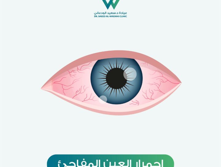 احمرار العين المفاجئ يعد حالة شائعة قد تواجه الكثيرين في مختلف المراحل العمرية.