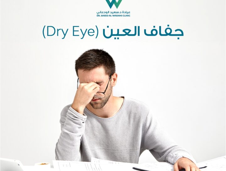 جفاف العين هو حالة شائعة يمكن أن تؤثر على أي شخص في أي عمر. يحدث عندما لا تفرز العين ما يكفي من الدموع أو عندما تكون الدموع غير فعالة في ترطيب العين.