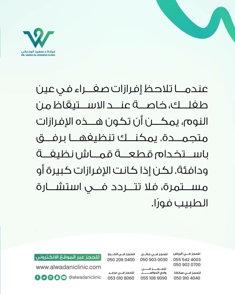 إفرازات العين الصفراء عند الأطفال يمكن أن تكون ناتجة عن عدة أسباب، بما في ذلك التهابات العين البكتيرية أو الفيروسية، أو انسداد القنوات الدمعية. في بعض الحالات، قد تكون هذه الإفرازات مصحوبة بأعراض أخرى مثل الاحمرار أو التورم.