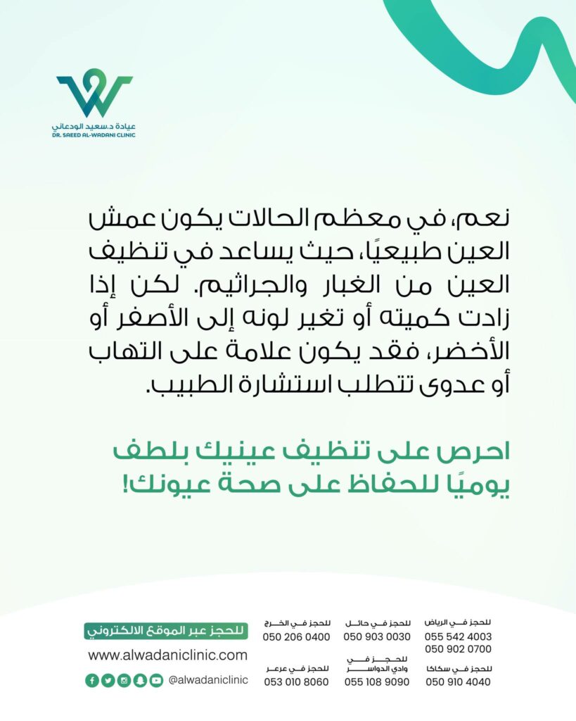 يُعرف عمش العين بأنه تجمع إفرازات مخاطية أو دمعية جافة حول الجفون والرموش، ويظهر عادة عند الاستيقاظ من النوم. هذه الإفرازات تتكوّن نتيجة عمل طبيعي يقوم به الجسم لتنظيف العين من الغبار، الخلايا الميتة، والجراثيم. وغالبًا ما تكون بلون شفاف مائل للبياض، أو صفراء خفيفة.