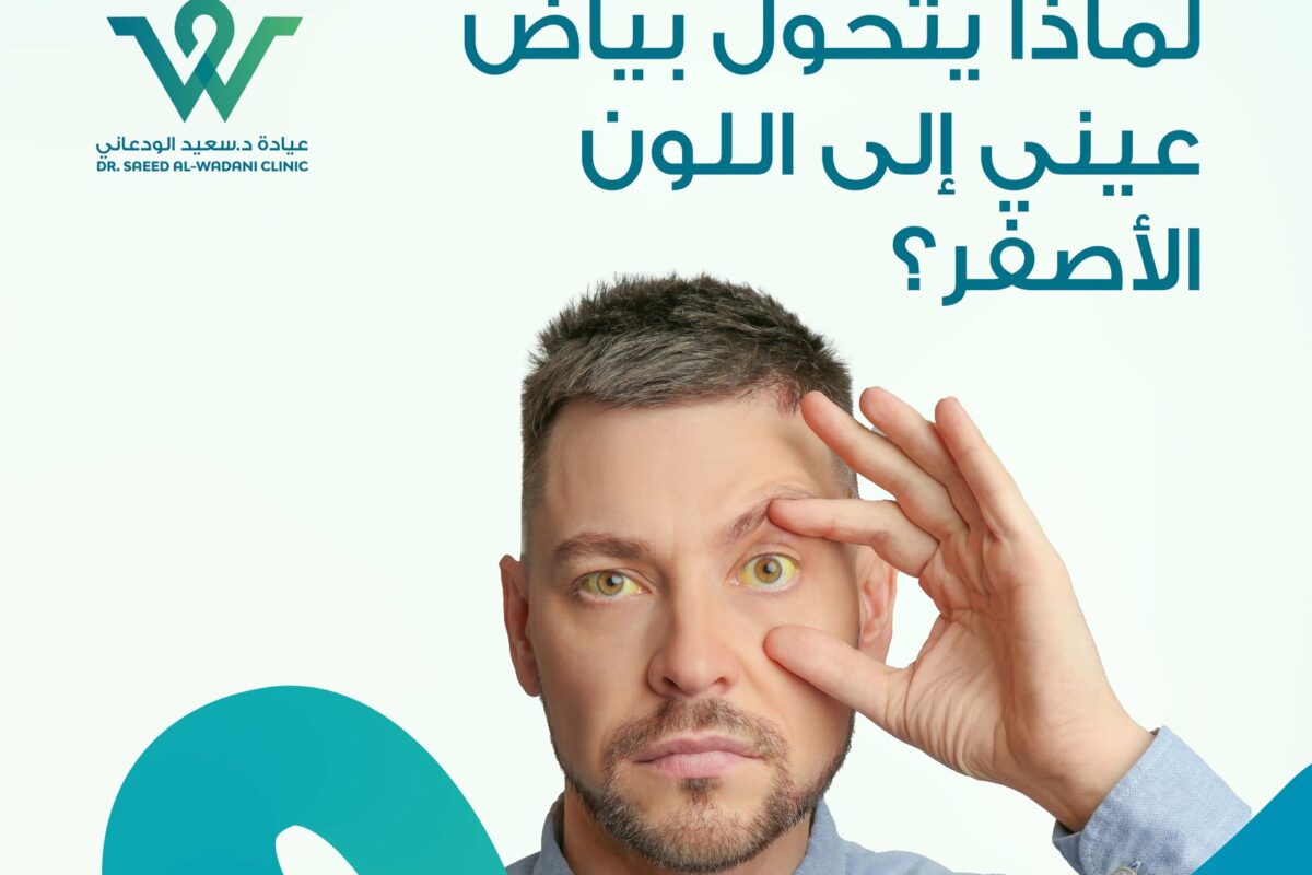 اصفرار العين مؤشر صحي قد يكشف عن مشاكل في الكبد أو المرارة. تعرّف على الأسباب، الأعراض الخطيرة، ومتى يجب زيارة الطبيب.