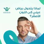 اصفرار العين مؤشر صحي قد يكشف عن مشاكل في الكبد أو المرارة. تعرّف على الأسباب، الأعراض الخطيرة، ومتى يجب زيارة الطبيب.
