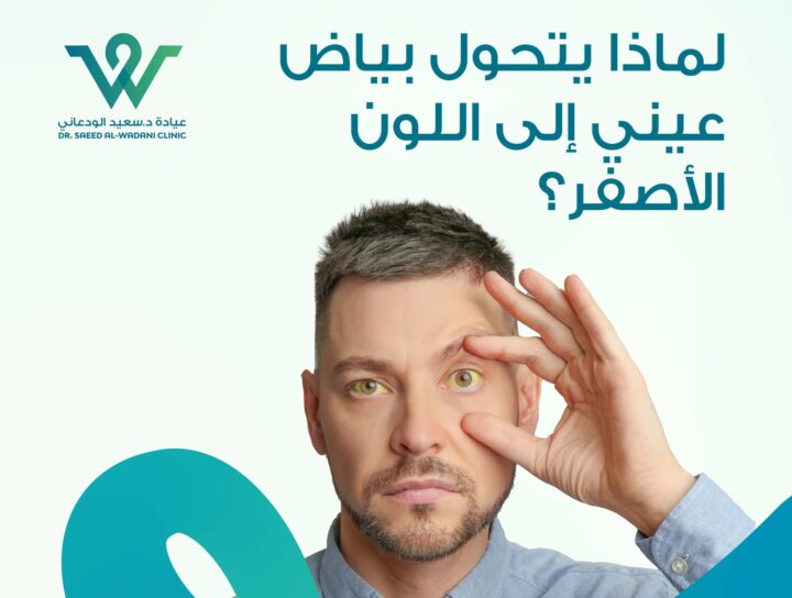 اصفرار العين مؤشر صحي قد يكشف عن مشاكل في الكبد أو المرارة. تعرّف على الأسباب، الأعراض الخطيرة، ومتى يجب زيارة الطبيب.