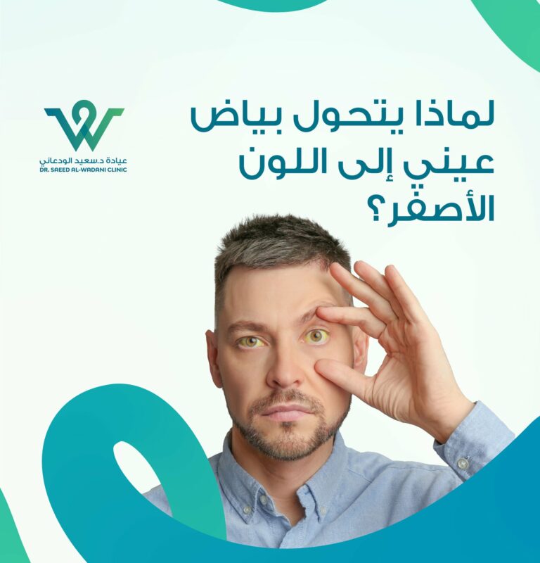 اصفرار العين مؤشر صحي قد يكشف عن مشاكل في الكبد أو المرارة. تعرّف على الأسباب، الأعراض الخطيرة، ومتى يجب زيارة الطبيب.