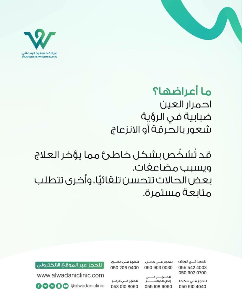 أبرز الأعراض:

احمرار العين

شعور بالحرقان أو وخز

تشوش في الرؤية

الإحساس بجسم غريب في العين

حساسية من الضوء

دموع مفرطة كرد فعل للجفاف