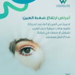 أعراض ارتفاع ضغط العين تشمل الاحمرار، الهالات الضوئية، تشوش الرؤية والصداع. تصميم توعوي لعيادة د. سعيد الودعاني للعيون.