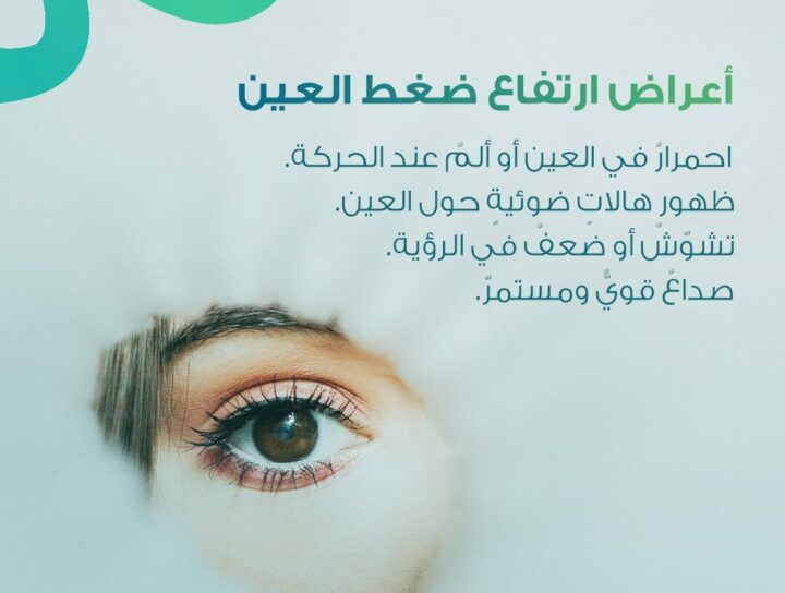 أعراض ارتفاع ضغط العين تشمل الاحمرار، الهالات الضوئية، تشوش الرؤية والصداع. تصميم توعوي لعيادة د. سعيد الودعاني للعيون.