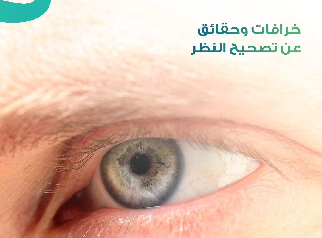 صورة عين بشرية توضح موضوع خرافات وحقائق تصحيح البصر وتقنيات الليزك الحديثة في السعودية