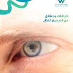 صورة عين بشرية توضح موضوع خرافات وحقائق تصحيح البصر وتقنيات الليزك الحديثة في السعودية