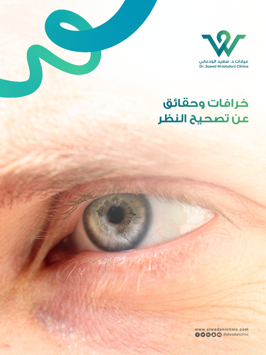 صورة عين بشرية توضح موضوع خرافات وحقائق تصحيح البصر وتقنيات الليزك الحديثة في السعودية