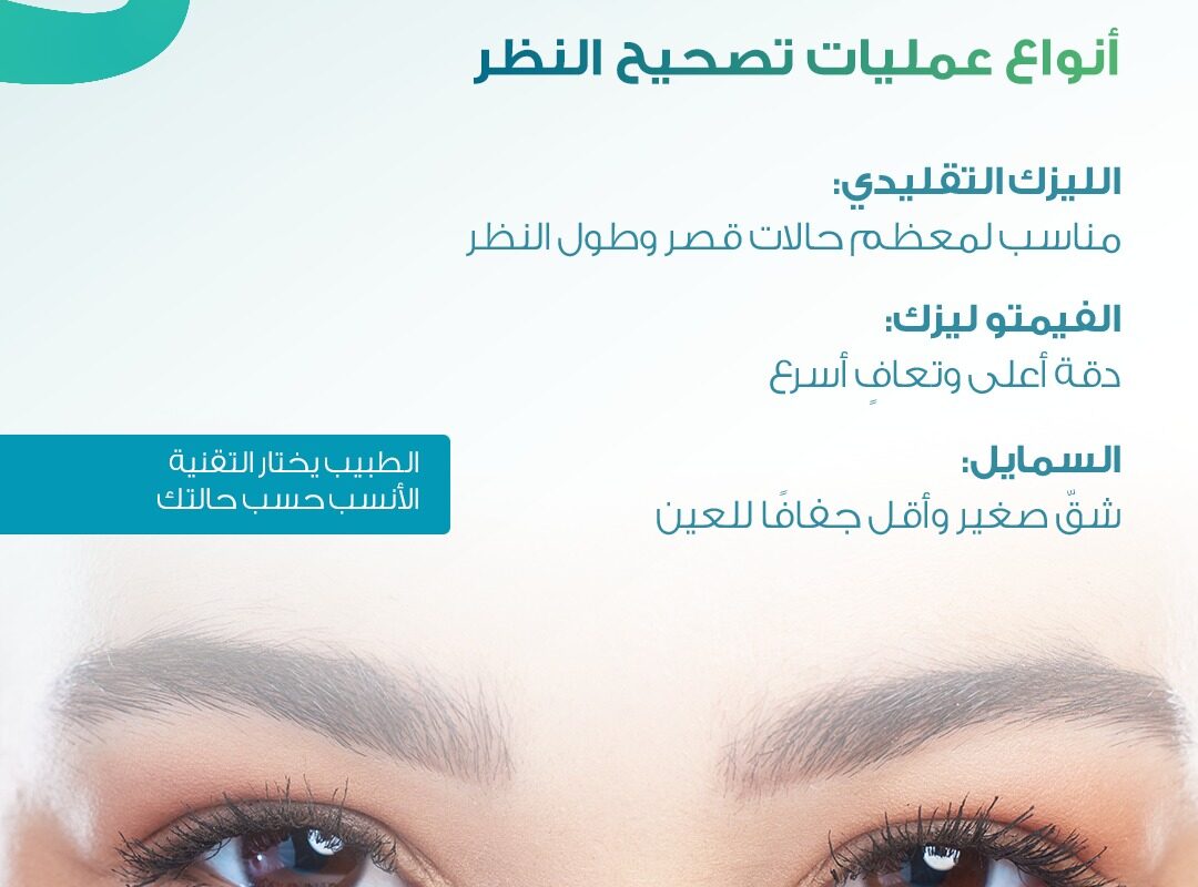 أنواع عمليات تصحيح النظر بالليزر مثل الليزك والفيمتو ليزك وتقنية سمايل في عيادات العيون بالسعودية