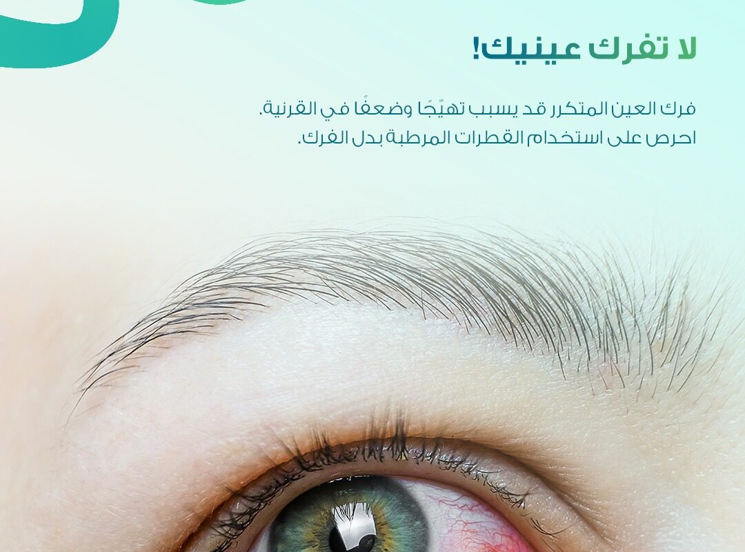 عين تعاني من الاحمرار بسبب جفاف العين مع توعية باستخدام القطرات المرطبة للحفاظ على صحة العين