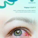 عين تعاني من الاحمرار بسبب جفاف العين مع توعية باستخدام القطرات المرطبة للحفاظ على صحة العين