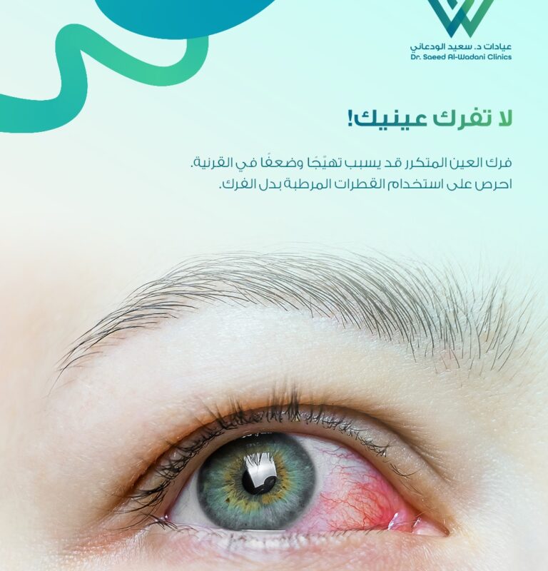عين تعاني من الاحمرار بسبب جفاف العين مع توعية باستخدام القطرات المرطبة للحفاظ على صحة العين