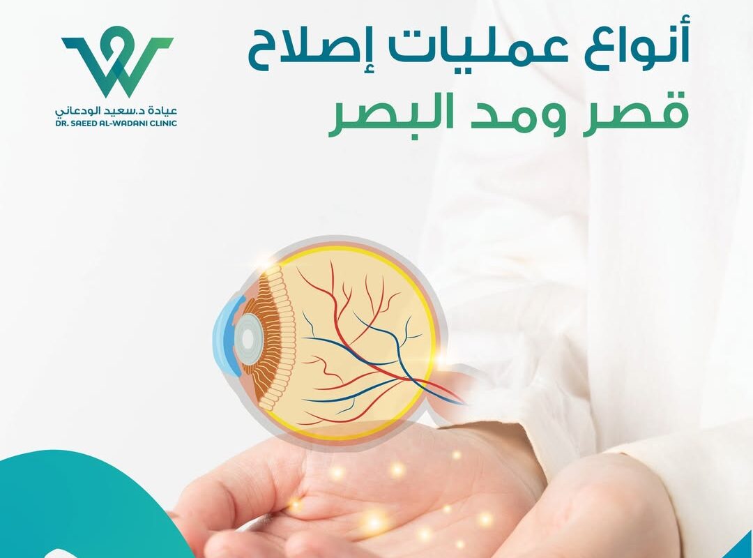 تصميم طبي من عيادة د. سعيد الودعاني يوضح موضوع أنواع عمليات إصلاح قصر ومدّ البصر، مع رسم توضيحي للعين فوق يدي طبيب وخلفية بيضاء بلون طبي هادئ.