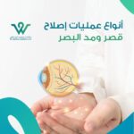تصميم طبي من عيادة د. سعيد الودعاني يوضح موضوع أنواع عمليات إصلاح قصر ومدّ البصر، مع رسم توضيحي للعين فوق يدي طبيب وخلفية بيضاء بلون طبي هادئ.