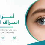 صورة توضيحية لمقال أعراض انحراف العين توضح أبرز العلامات والأسباب ومتى يجب زيارة طبيب العيون.