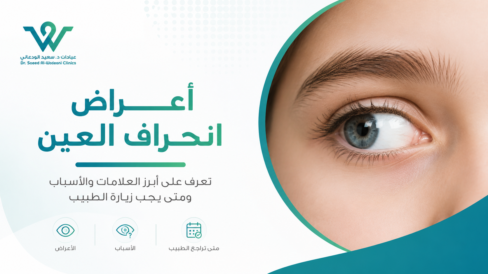 صورة توضيحية لمقال أعراض انحراف العين توضح أبرز العلامات والأسباب ومتى يجب زيارة طبيب العيون.
